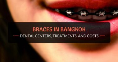 braces in bangkok