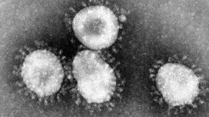 Coronaviruses