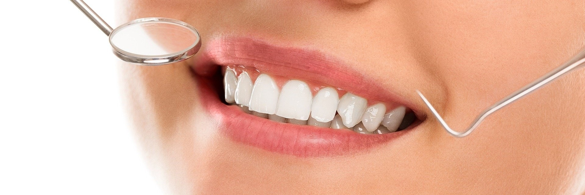 bright smile
