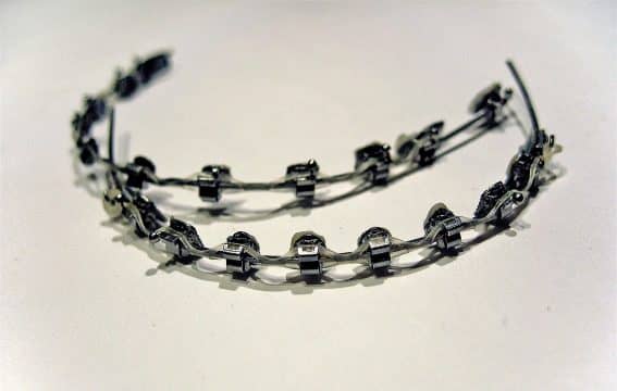 metal braces